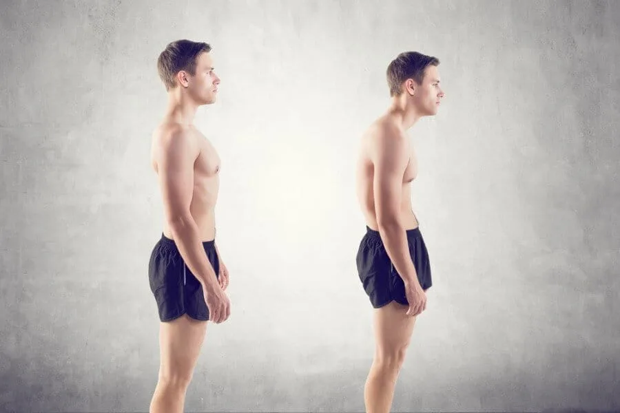 Example of bad posture standing up